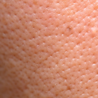 Open Pores